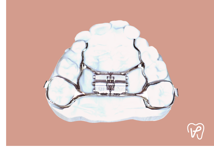 Traitement interception orthodontie Traitement interception orthodontie